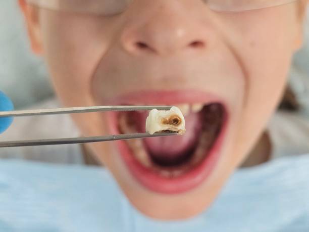 Best Emergency Dentist for Special Needs Patients in Linden, TN