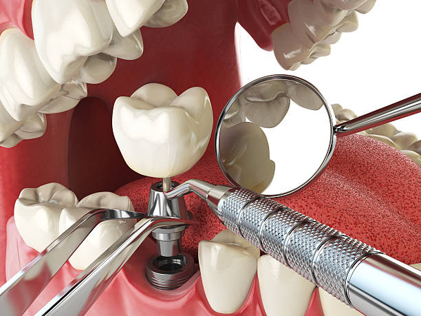 Best Emergency Dentist for Special Needs Patients in Linden, TN