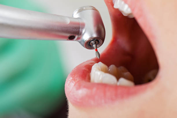 Best Holiday Emergency Dentist in Linden, TN